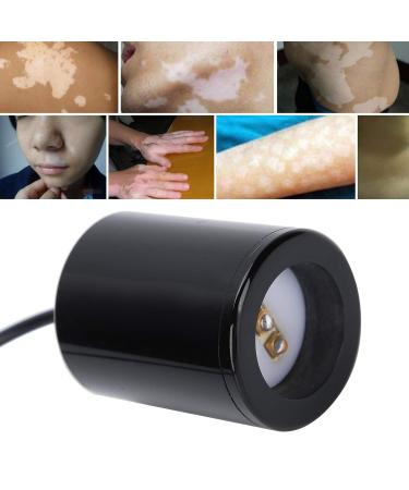 White Spot Treatment Device - Vitiligo, Pityriasis Rosea, Psoriasis, Eczema - Strong Energy - 5V - Plastic - Buy Online on GoSupps.com