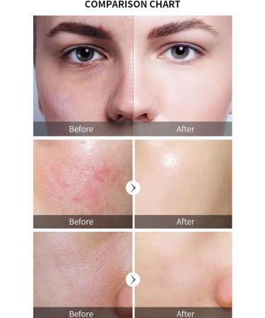  Lambo AHA facial essence exfoliating skin serums skin-brightening AHA acid pore-soothing essential oil (30 ml) - Buy Online on GoSupps.com