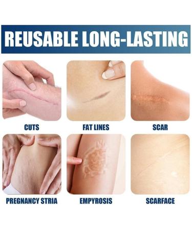 Silicone Skin Renewal Gel - Women's Treatment for Surgical Scars, Stretch Marks, Acne, Burn Scars & Pockmarks - 1pcs - Buy Online on GoSupps.com
