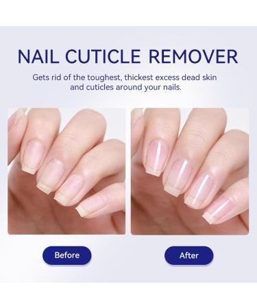 Adoucisseur de cuticules Solution nourrissante pour soins des ongles traitement hydratant pour les mains et les pieds | Dissolvant de cuticules action rapide 30ml pour peaux s ches et endommag  - Buy Online on GoSupps.com