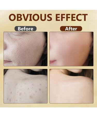 Natural Bee Venom Cream with Organic Royal Jelly - Anti-Aging Face Moisturizer for Wrinkle Reduction and Firming - Daily Renewal Treatment for Mature Skin 1 Count (Pack of 1) - Buy Online on GoSupps.com