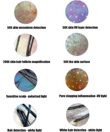 Skin Scalp Detector 13 Inch HD LCD Screen Skin Hair Follicle Detector Skin Hair Scalp Analysis Digital Skin Detector Moisture Tester Rechargeable Hair Follicle Skin Analyser - Buy Online on GoSupps.com