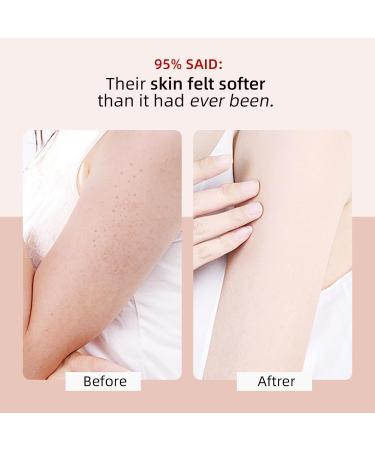 KP Bump Eraser Body Scrub | Exfoliating Face Scrub for Men & Women | AHA BHA Coffee Scrub for Ingrown Hair & Keratosis Pilaris - 4.23OZ - Buy Online on GoSupps.com