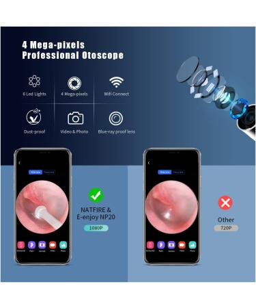 Wireless Ear Wax Removal Tool | 1280P Camera & Cleaner Kit | Otoscope Endoscope for Earwax Removal - Buy Online on GoSupps.com