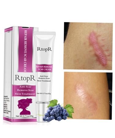 Healifty Scar Cream Gel for Face & Body - Stretch Mark & Scar Remover Treatment - 2 Pcs Assorted Colors - Buy Online on GoSupps.com