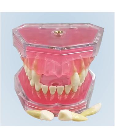 Tooth Lessons Model - Dental Simulation & Standard Practice Demonstration | Resin Dentist Teaching Tool (Pink Rose) - International Shipping Available - Buy Online on GoSupps.com