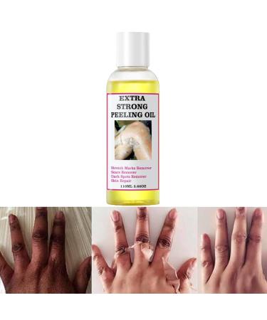 Extra Strong Yellow Peeling Oil | Exfoliating Solution for Body Hands Feet & Face | All Skin Types - 110ML - Buy Online on GoSupps.com