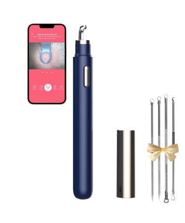 Blackhead Remover with Camera  WiFi Visual Blackhead Remover Tools with White/Blue Lights for iPhone  Android Phones Women Gift (Blackhead Remover - Navy Blue)