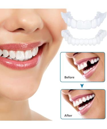 Flipped Warm Artificial Teeth Dentures - 2 Pairs of Temporary Plug-In Veneers for Brightening & Natural Look - Buy Online on GoSupps.com