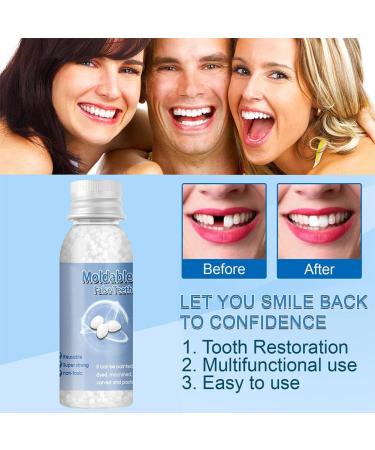 Surakey Tooth Repair Granulate - Temporary Tooth Filling Set for Missing & Broken Teeth (3 Pieces) - Fast & Effective Repair Solution - Buy Online on GoSupps.com
