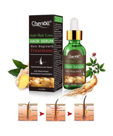 Hair Growth Serum - Stimulate New Growth, Thicker & Fuller Hair - Hair Loss & Thinning Treatment - Buy Online on GoSupps.com