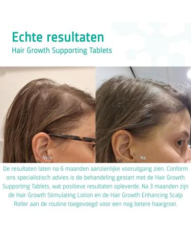 Neofollics Beard Growth Supporting Tablets Beard growth tablets for men With biotin EGCG and natural DHT blockers Supports fuller stronger and thicker beard growth 60 pieces - Buy Online on GoSupps.com