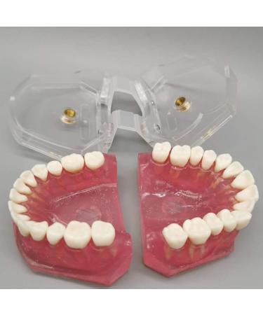 Nvivn Oral Implant Practice Model | Dental Training & Research Tool for Global eCommerce - Buy Online on GoSupps.com