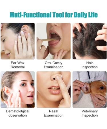 Ear Wax Removal Kit with Camera for Phones - Ear Cleaner Tools Set - White - Buy Online on GoSupps.com