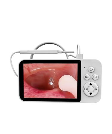 Ear Wax Removal Tool Camera Earwax Removal Kit Ear Cleaner with Camera 4.3'' Screen Earwax Remover
