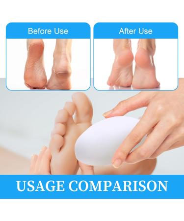 Creative Egg Foot Grinder Portable Egg Callus Remover Egg Shape Foot Scrubber Perfect for Foot Spa Egg Shaped Foot Scrubber Home Salon and Removing Tough Calluses and Dry Skin - Buy Online on GoSupps.com