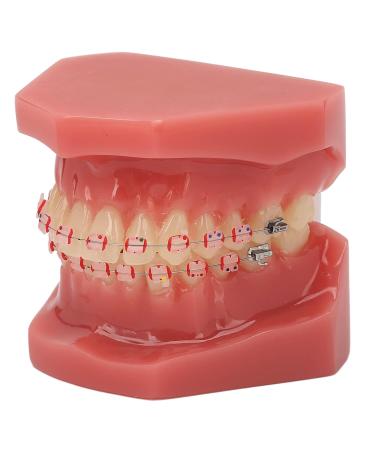 Orthodontic Demonstration Model for Dental Research | Metal Wires & Ceramic Brackets | Teaching Aids for Adults - Buy Internationally - Buy Online on GoSupps.com