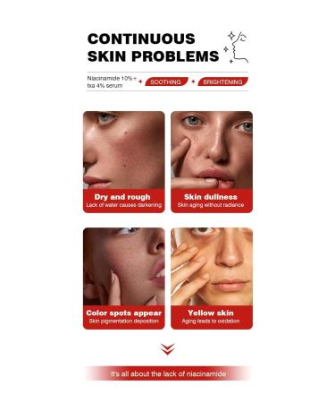 Niacinamide 10 + TXA 4 Serum Hyaluronic Acid Tranexamic acid Facial Serum for Glass Skin Clarifying Radiant Complexion with Natural Color Korean Skin Care (30ml /1.01 fl.oz) - Buy Online on GoSupps.com