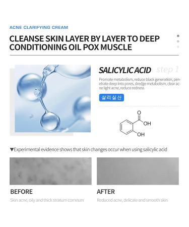 DEleventh Korean Acne Clarifying Cream 30g - With Salicylic Acid & Vitamin B5 for Clear Skin Blemish Control & Hydration | Shop Internationally - Buy Online on GoSupps.com