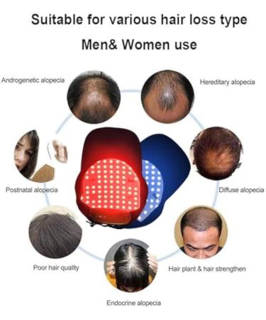 Casque De Croissance des Cheveux - Casque De Th rapie Lumi re Rouge pour La Repousse des Cheveux Et La Perte De Cheveux pour Les Hommes Et Les Femmes avec 48 Lampes - Rechargeable - Buy Online on GoSupps.com