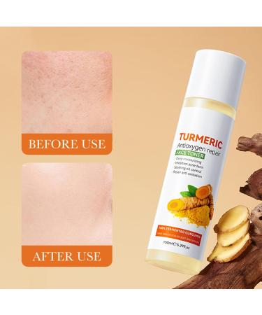 Turmeric Toner 150 ml Turmeric toner for skin protection and hydration turmeric facial toner blackening deep hydration firming & moisturizing Turmeric Toner - Buy Online on GoSupps.com