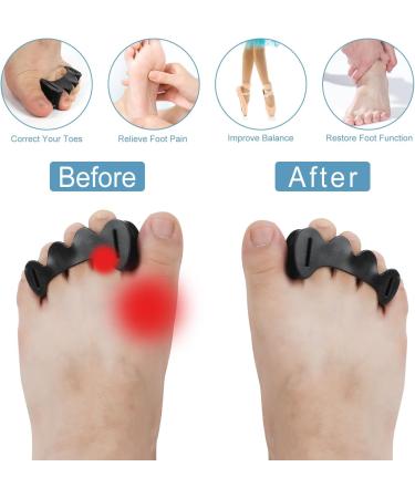 Adjustable Silicone Toe Spacers for Hammer Toes - 2 Pairs - Toe Straighteners for Women Men - Black M - Buy Online on GoSupps.com