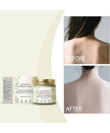 Skin firming cream 60 g firming moisturizer against skin sagging moisturizing care for arms legs abdomen after showering day and night - Buy Online on GoSupps.com