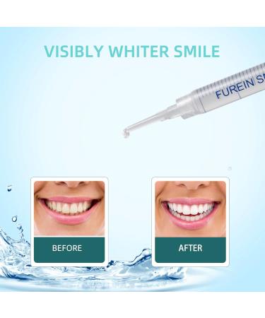 Teeth Whitening Gel Refills - 12 Treatments 35% Carbamide Peroxide | Remove Years of Stains | International Shipping Available - Buy Online on GoSupps.com