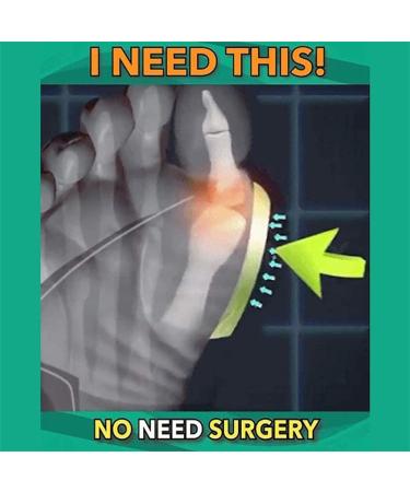 Bunion Corrector Sandals for Women | MisFun Breathable Bunion Correction Sandals - Black, Size 6 - Buy Online on GoSupps.com