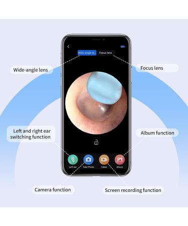 NATON Ear Wax Removal Kit - 1920P FHD Wireless Otoscope Ear Camera with 7 PCS Ear Spoon, Waterproof Ear Wax Remover for Adults, Kids, and Pets - Compatible with iOS and Android - Buy Online on GoSupps.com
