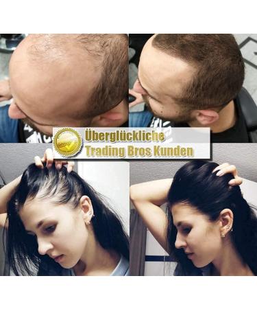  Trading Bros Hair Trading Bros Instant Thickening Thick Hair 28g Dark Brown XXL - Buy Online on GoSupps.com