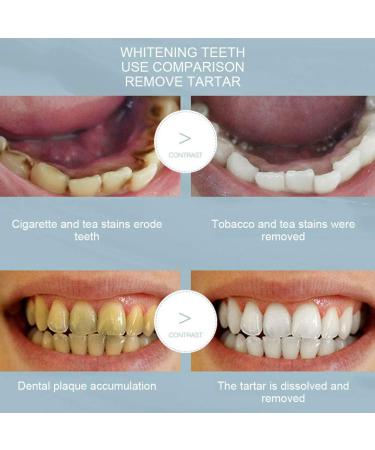 Verdant Touch Oral Care Liquid - 60ml Mousse Tartar Removal for Fresh Breath & Healthy Teeth - International Shipping - Buy Online on GoSupps.com