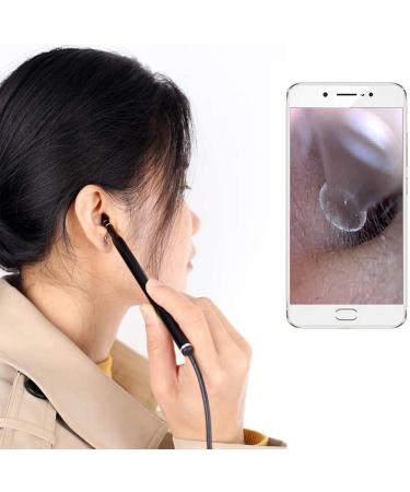 RMENST Ear Wax Removal Kit with HD Endoscope Camera - Earwax Removal Tool for Adults & Kids - Buy Online on GoSupps.com