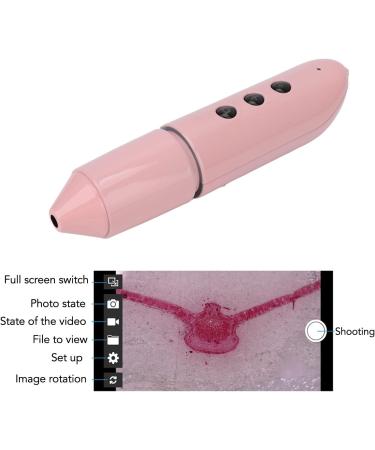 D tecteur de Cuir Chevelu Diagnostic de Peau Analyseur de Cheveux Cam ra 1MP Grossissement 100X pour Cha ne de beaut  - Buy Online on GoSupps.com