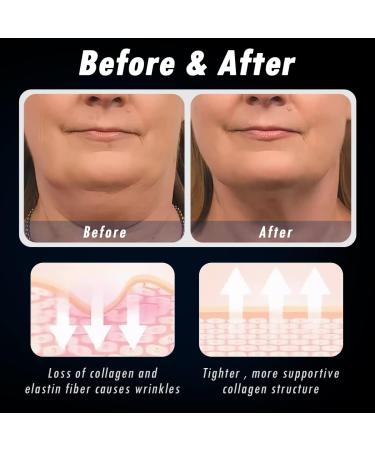 OneNine 2023 New Sleeping V-Face Beauty Device Sleeping V-Face Beauty Device Sleeping V-Face Beauty De for Men and Women - Buy Online on GoSupps.com