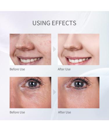 COSBEAUTY Skin Scrubber & Blackhead Remover - 4 Modes, Waterproof, Wireless Rechargeable (White) - Buy Online on GoSupps.com