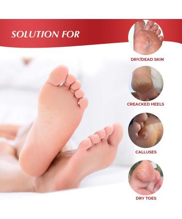 Exfoliating Foot Peel Mask For Softer Smooth Feet- Gently Peel Away Calluses & Dead Skin Repair Rough Heels Get Beautiful Baby Feet in 7 Days (2 Pack) - Buy Online on GoSupps.com