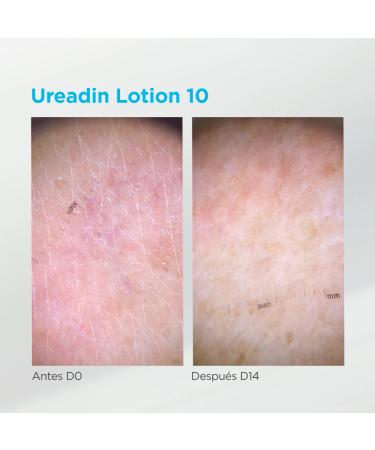 UREADIN LOCION 10 2x750ml - Hydrating Skin Lotion | 60% Off - International Shipping Available - Buy Online on GoSupps.com