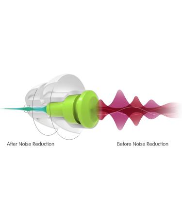 MSA SoundOut Ear Plugs for Sleeping | Reusable Comfortable Side Sleeper Ear Plugs | Noise Reduction & Snoring Relief | Hypoallergenic with Acoustic Filters & Travel Case - Buy Online on GoSupps.com