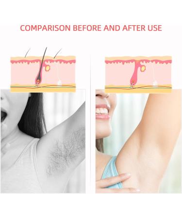 LIARTY Wack Marking Set - Painless Waxing Hair Remover | Double Woor Warler - Warm Wax Waxing for Smooth Skin (Pink) - Buy Online on GoSupps.com