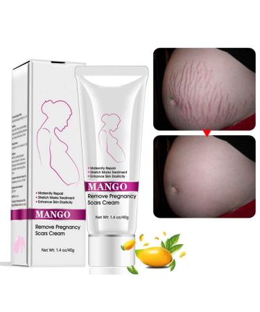 Stretch Mark Cream For Pregnancy Repair Scar Slack Line Abdomen Stretch Marks Cream Remove Stretch Marks From Pregnancy Repair Scar Slack Line Abdomen Stretch Marks Postpartum 1Pack