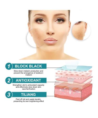 Dark Spot Correcting Serum - Best Dark Spot Remover for Age Spots Sun Spots & Freckles - 30g Body Cream - Buy Online on GoSupps.com