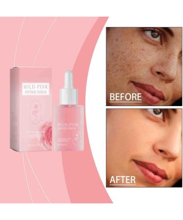 Rose Pink Peptide Serum Pink Glow Serum Peptide Whitening Serum Niacinadmie Serum Hydrating & Moisturizing & Firming Uneven Skin Tone Pore Care Korean Skincare (1) - Buy Online on GoSupps.com