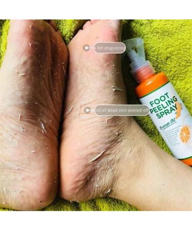 Foot Peeling Spray Natural Orange Essence Remove Foot Dead Skin Exfoliating Foot Moisturizing Hydrating Foot Peeling Spray Orange Oil for Cracked Rough Heels & Calluses - Buy Online on GoSupps.com