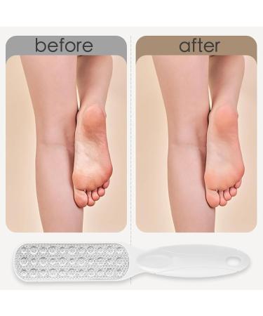 Foot File Foot Scraper for Hard Skin Professional Pedicure Double Side Foot Files Callus Remover Foot Scrubber Metal Foot Rasp Foot Care Tool for Dead Skin Cracked Heels Corn Removal - Buy Online on GoSupps.com