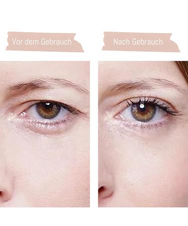 180 Pieces Invisible Eyelid Strips - Breathable Tapes in 2 Sizes | Eyelid Sticker & Strips for a Perfect Lift - Buy Online on GoSupps.com