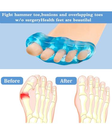 Buy 2 Pairs Gel Toe Separators Relief for Overlapping & Curved Toes | Pain Protection for Men & Women - International Shipping - Buy Online on GoSupps.com