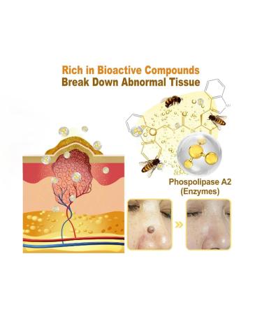 Bee Venom Cream 2026 New Bee Venom Marks Spots Removal Treatment Cream for All Skin Types (1) - Buy Online on GoSupps.com