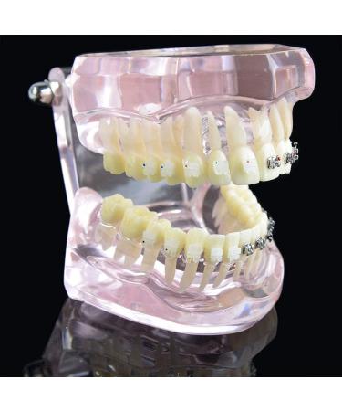 Samnuerly Dental Orthodontic Brackets Model - Ideal for Research & Treatment in Dentistry | International Shipping - Buy Online on GoSupps.com