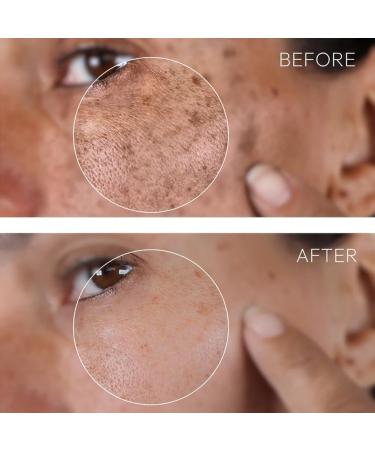 FLLUOUZH 2 Pcs Dark Spot Corrector Dark Spot Remover Advanced Brightening Technology for Face and Hands Reduce Hyperpigmentation Restore Natural Glow - Buy Online on GoSupps.com